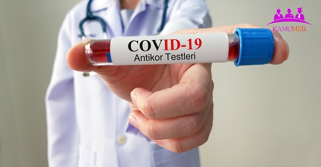 Covid-19 (SARS-CoV-2 Enfeksiyonu) Antikor Testi (RESMİ YAZI)
