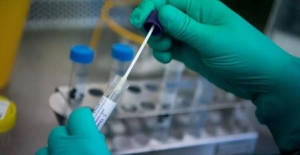 Zorunlu PCR Testi Uygulanabilir Değil